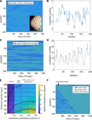 Commentary: Localization of contractile wave nucleation sites as an emerging phenomenon of stochastic myogenic gut motility